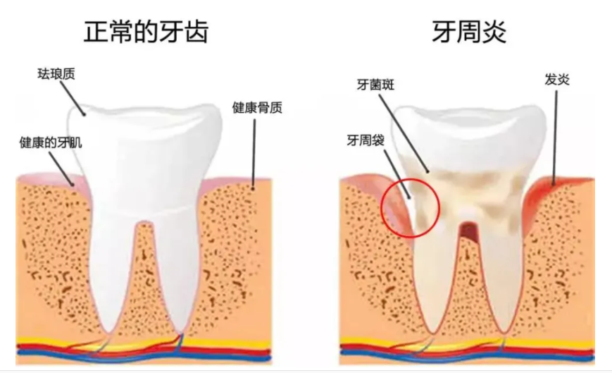 对比